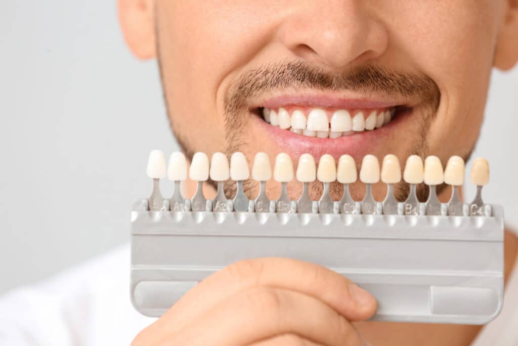 Dentistry on Wellington cosmetic veneer shade matching and smile makeover consultation